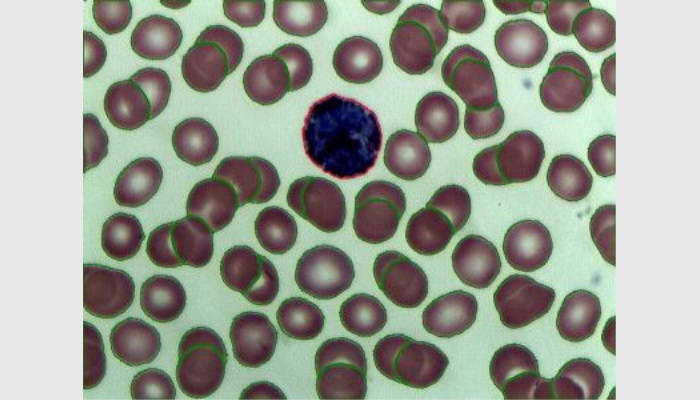 MIA-V生物顯微圖像分析儀系統(tǒng),細胞計數(shù)分析儀
